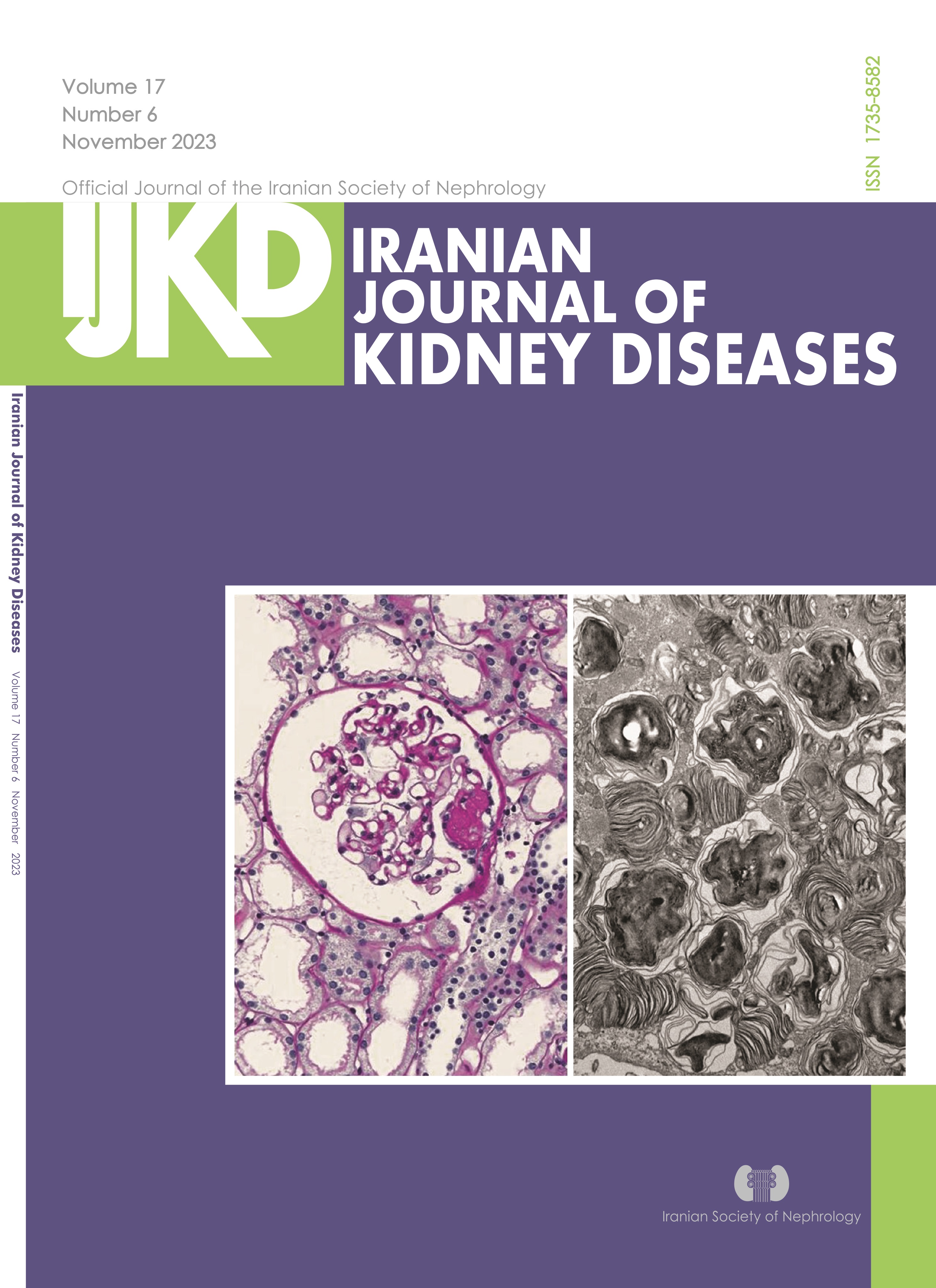 The latest issue of IJKD journal has been published